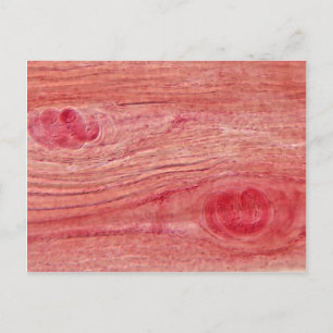 Postal Parasite Trichinella Spiralis
