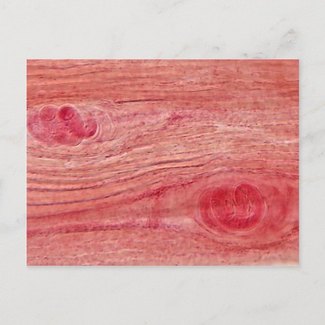 Postal Parasite Trichinella Spiralis (Anverso)