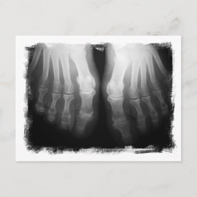 Postal Pie de rayos X Humano Skeleton Hueso Negro y Blanc (Anverso)