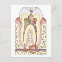 Pulpa y absceso de raíz