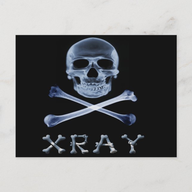 Postal RADIOLOGÍA DE LA bandera de XRAY PIRATE JOLLY ROGE (Anverso)