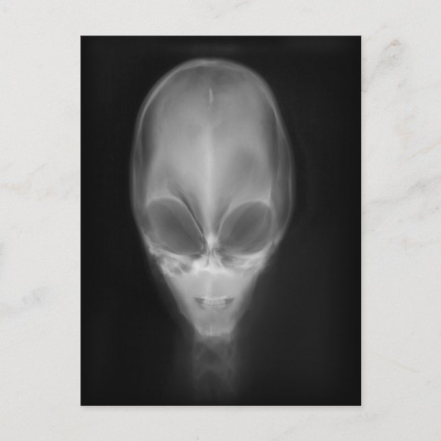 Postal Rayo X Alien Skull (Anverso)