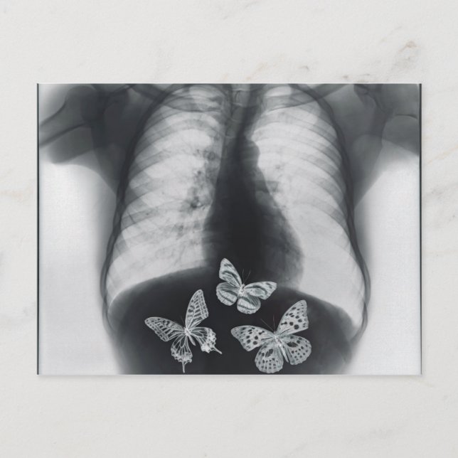 Postal Rayos X de mariposas en el estómago (Anverso)