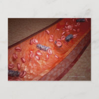 Renderización microscópica de una infección sanguí