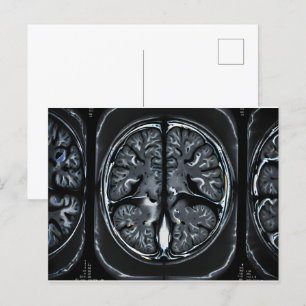 Postal Revisión cerebral por resonancia magnética