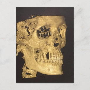 Postal Scary Skull