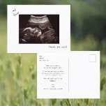Postal Simple Gracioso Ultrasonido Baby Shower Gracias<br><div class="desc">Simple Gracioso Ultrasonido Foto Baby Shower Gracias Postcard. La perspectiva del bebé. Gracias del bebé.</div>