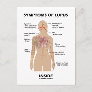 Postal Síntomas De Lupus Dentro (Trastorno Autoinmune)