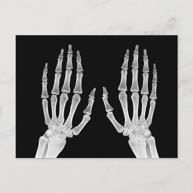 Postal Skeleton Hands Xray Picture Anatomía Humana foto (Anverso)