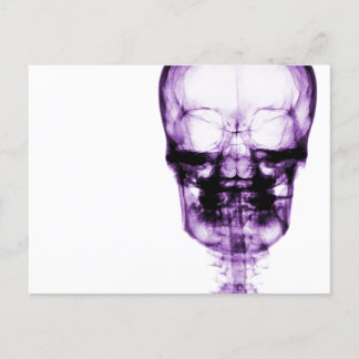Postal Skeleton Skeleton de visión de rayos X - Púrpura