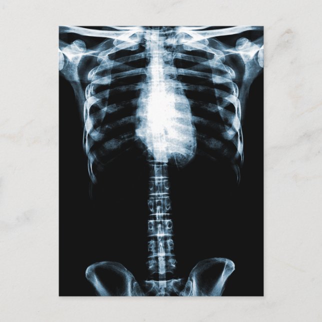 POSTAL SKELETON TORSO RIBS AZUL (Anverso)