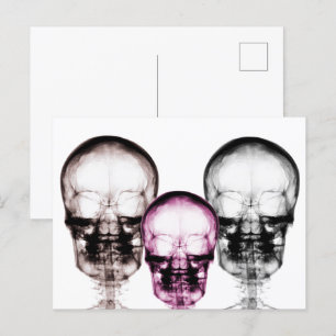 Postal Skeletons de visión de rayos X de color mixto