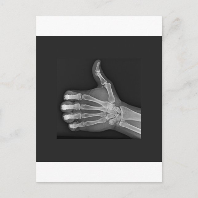 Postal Thumbup (Anverso)