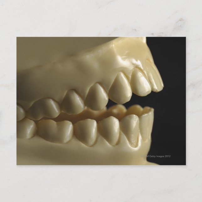 Postal Un modelo dental (Anverso)