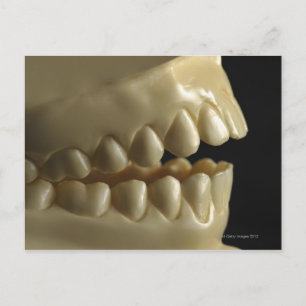 Postal Un modelo dental