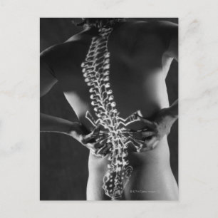 Postal Vista de la médula espinal