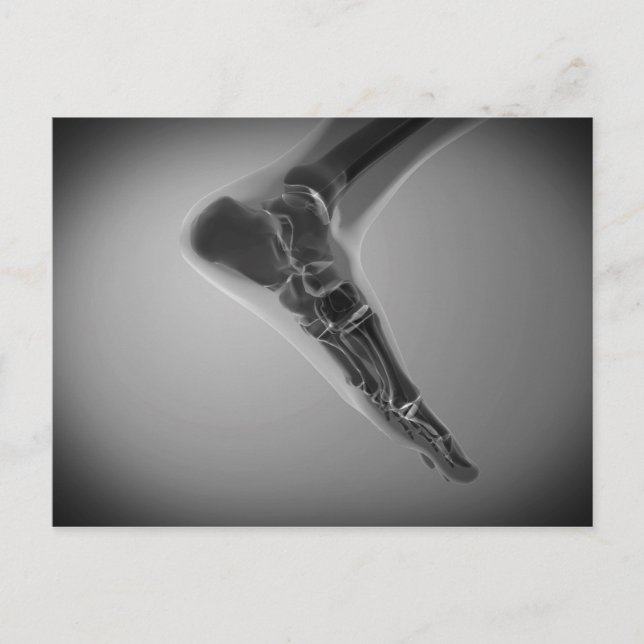 Postal Vista De Rayos X De Pie Humano 4 (Anverso)
