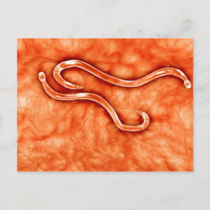 Postal Vista Microscópica De Hookworm 2