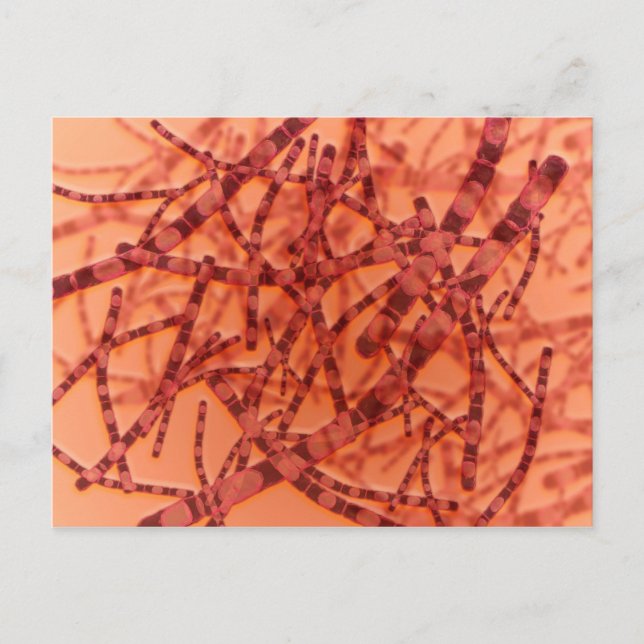 Postal Vista Microscópica Del Antrax 3 (Anverso)