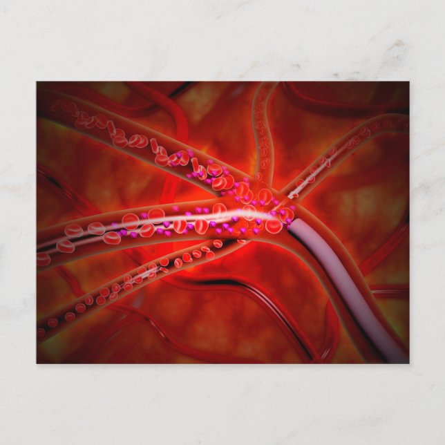 Postal Vista Microscópica Del Medicamento Que Se Está Iny (Anverso)