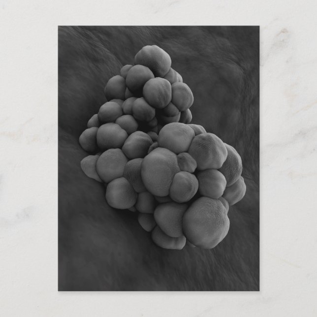 Postal Vista Microscópica Del Tumor 1 (Anverso)