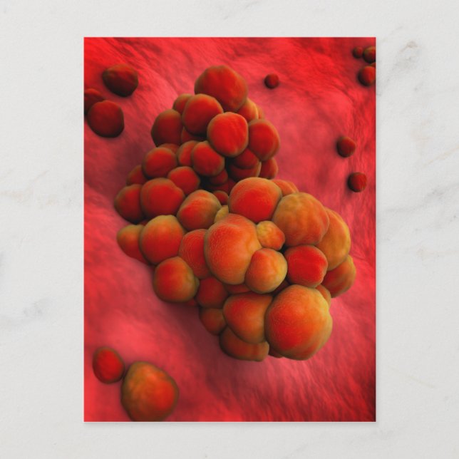 Postal Vista Microscópica Del Tumor 2 (Anverso)