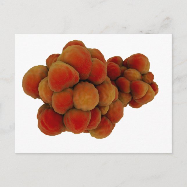 Postal Vista Microscópica Del Tumor 4 (Anverso)