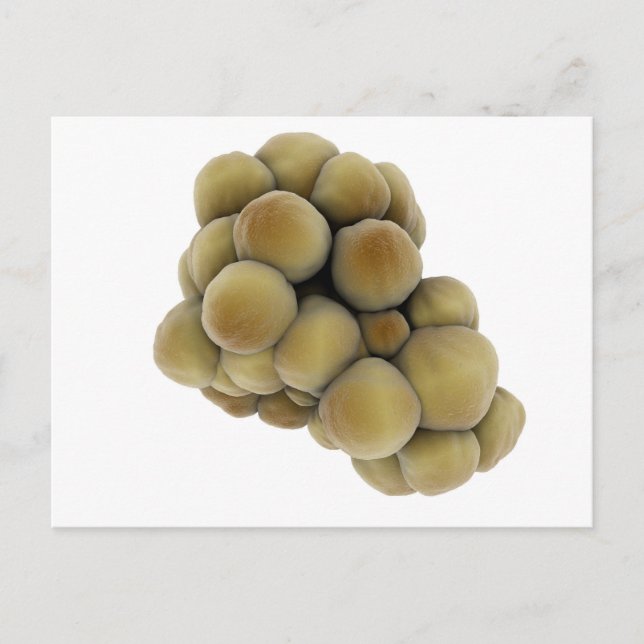 Postal Vista Microscópica Del Tumor 5 (Anverso)