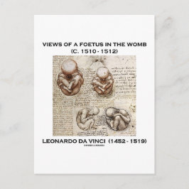 Postal Vistas De Un Feto En El Vientre (Leonardo da Vinci