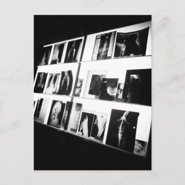Postal X-Rays (Anverso)