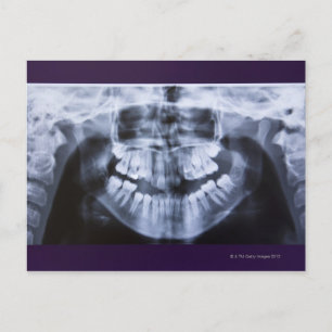 Postal Xray de una jawline de chicas tomada con una panor