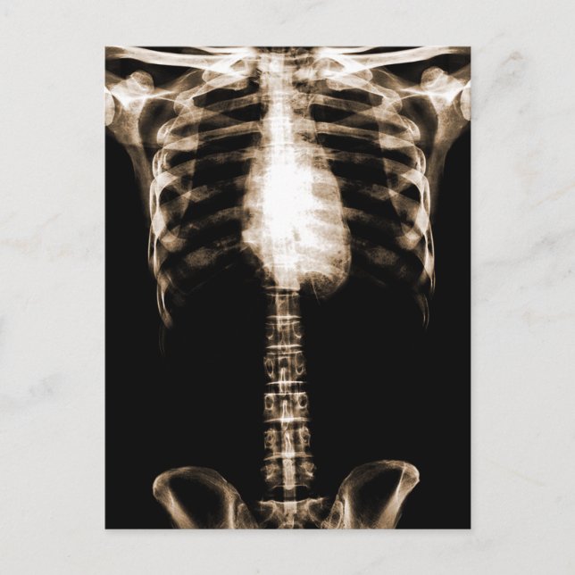POSTAL XRAY SKELETON TORSO RIBS SEPIA (Anverso)