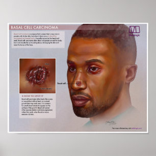 PÓSTER