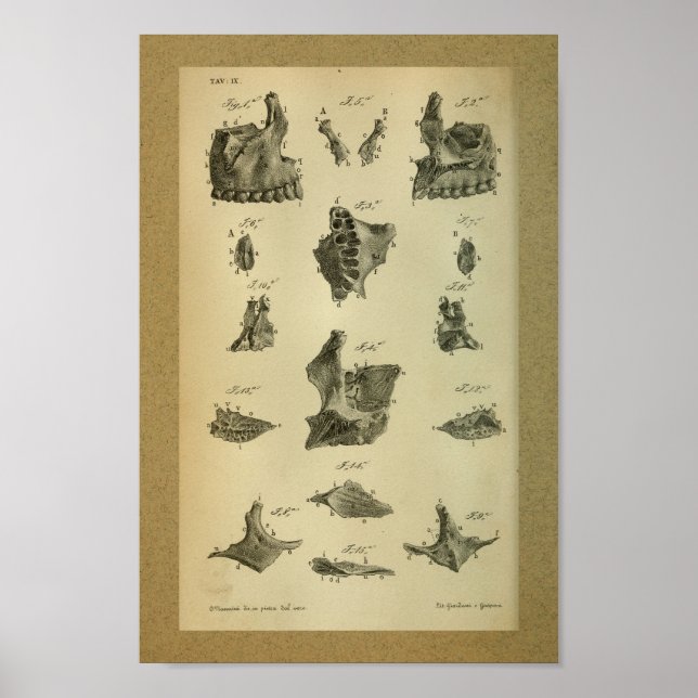 Póster 1850 Vintage Anatomy Print Maxilla (Frente)