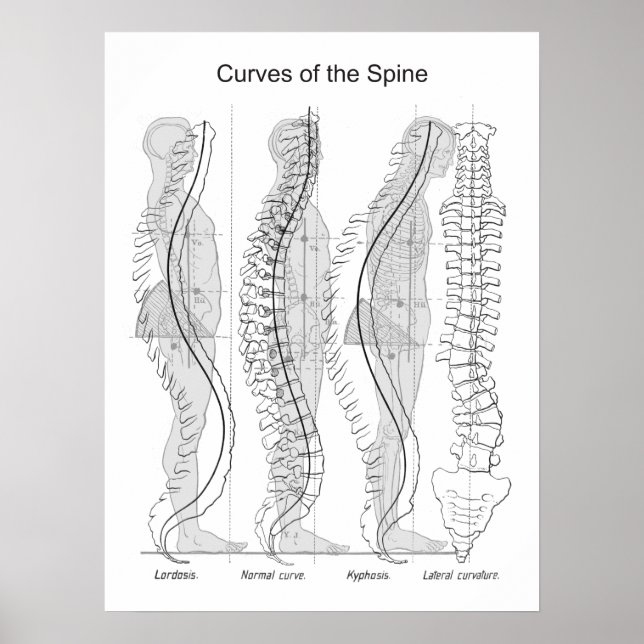 Póster Abnormal Curves of the Spine Poster Chiropractic (Frente)