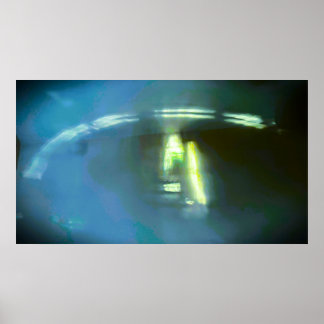 Póster Abstract Arc Light,