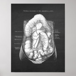 Póster Anatomía abdominal de Aorta