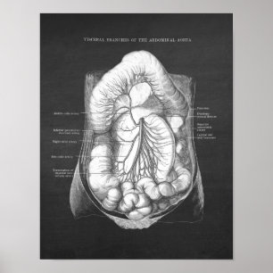 Póster Anatomía abdominal de Aorta