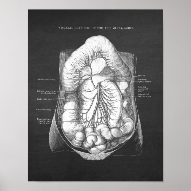 Póster Anatomía abdominal de Aorta (Frente)