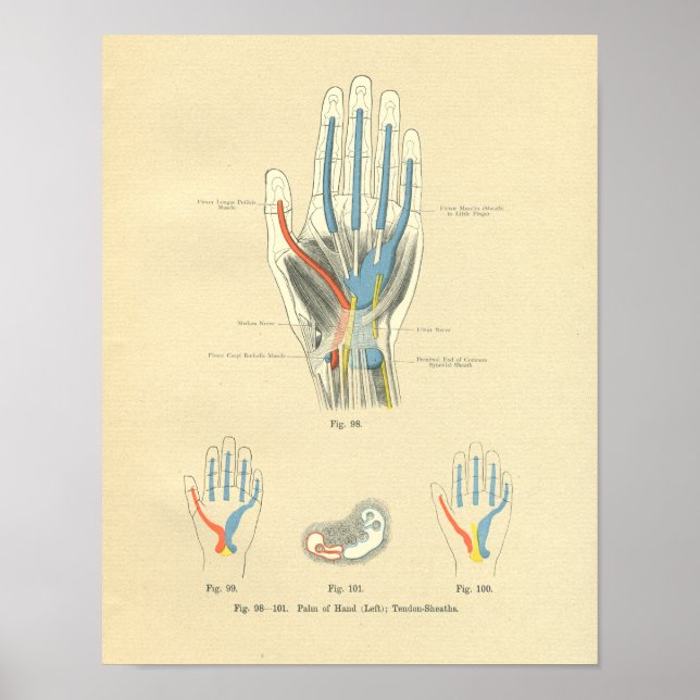 Póster Anatomía de manchas y tendones de escarcha de vint (Frente)