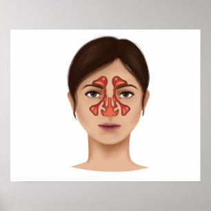 Póster Anatomía De Sinuses Nasales