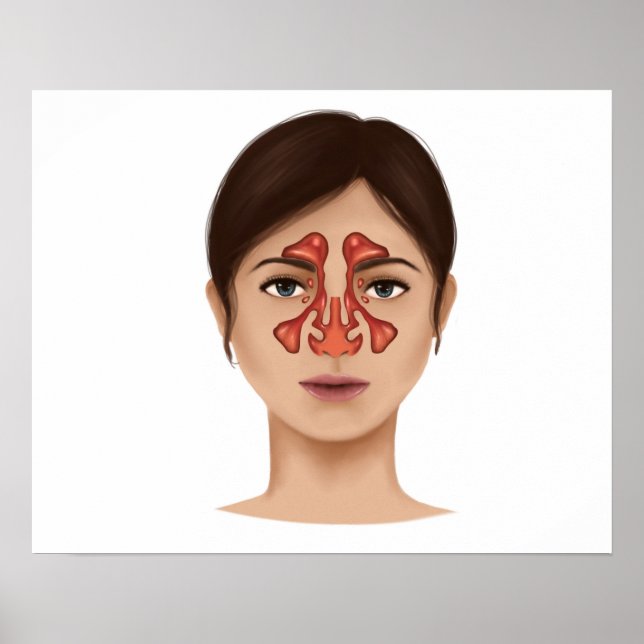 Póster Anatomía De Sinuses Nasales (Frente)