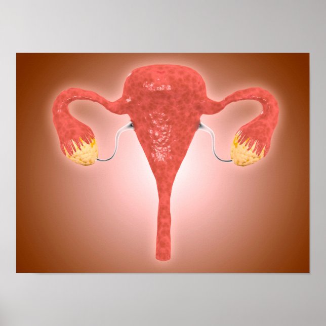Póster Anatomía De Utero Femenino Con Ovario (Frente)