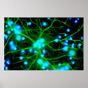 Póster Astrocyte Are Star Shaped Glial Cells in the Brain