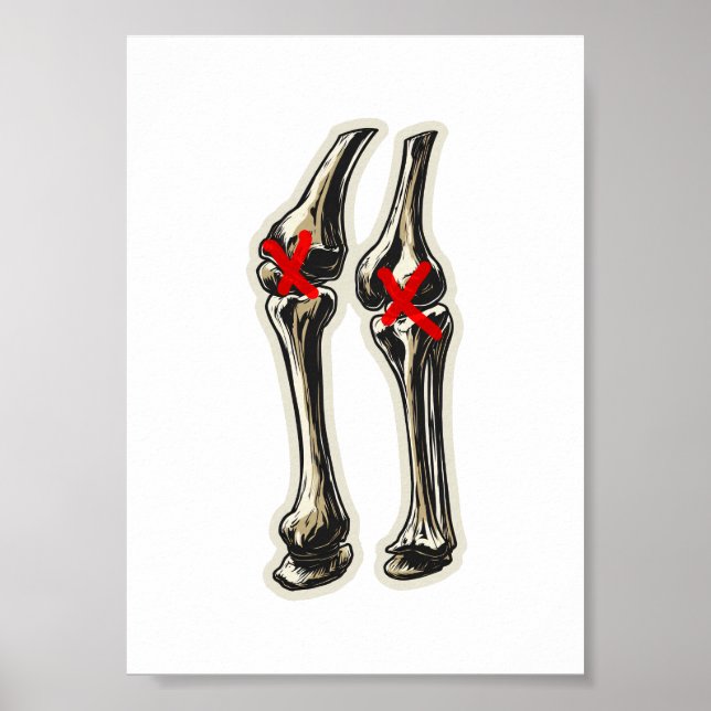 Póster Bad Knees – Funny Skeleton Knee Illustration (Frente)