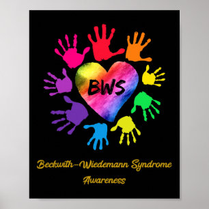 Póster Beckwith Wiedemann Syndrome Awareness Hands Gift