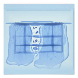 Póster Blue window.