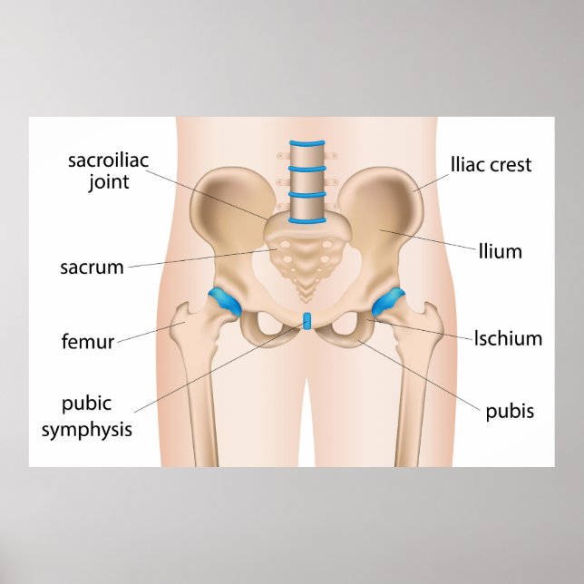 Póster Bursitis por dolor de cadera (Frente)