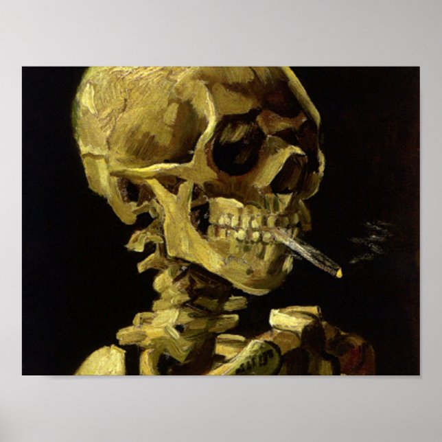 Póster Calavera de un esqueleto con una fuerte quemadura  (Frente)