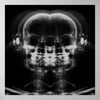 Póster Calaveras de doble rayos X con audífonos - B&W